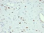 MyoD1 Antibody in Immunohistochemistry (Paraffin) (IHC (P))