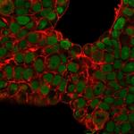 Nucleolin (Marker of Human Cells) Antibody in Immunocytochemistry (ICC/IF)