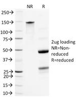Neurofilament (NF-L) (Neuronal Marker) Antibody in SDS-PAGE (SDS-PAGE)