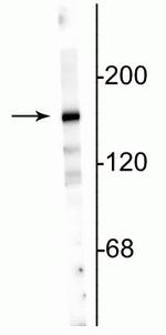 NMDAR2A Antibody in Western Blot (WB)