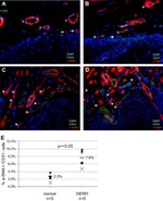 CD31 (PECAM-1) Antibody in Immunohistochemistry (IHC)