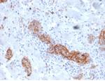 NGF-Receptor (p75)/CD271 (Soft Tissue Tumor Marker) Antibody in Immunohistochemistry (Paraffin) (IHC (P))