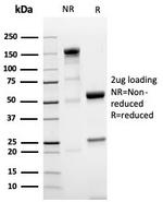 NKX3.1 Antibody in SDS-PAGE (SDS-PAGE)