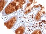 NTRK2 (Neurotrophic Receptor Tyrosine Kinase 2) Antibody in Immunohistochemistry (Paraffin) (IHC (P))