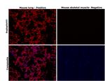 Podoplanin Antibody in Immunohistochemistry (Paraffin) (IHC (P))