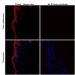 Pan Cytokeratin Antibody in Immunohistochemistry (Paraffin) (IHC (P))