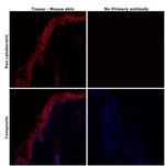 Pan Cytokeratin Antibody in Immunohistochemistry (Paraffin) (IHC (P))