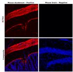 Desmin Antibody in Immunohistochemistry (Paraffin) (IHC (P))