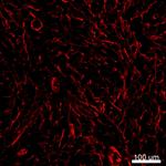 Alpha-Smooth Muscle Actin Antibody in Immunohistochemistry (IHC)