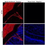 Alpha-Smooth Muscle Actin Antibody