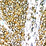 CD20 Antibody in Immunohistochemistry (Paraffin) (IHC (P))