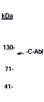 c-Abl Antibody in Western Blot (WB)