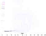 beta-Defensin 1 Antibody in Western Blot (WB)