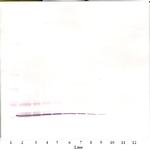 Eotaxin Antibody in Western Blot (WB)