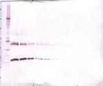 M-CSF Antibody in Western Blot (WB)