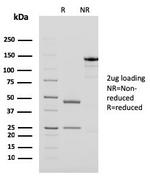 PAPP-A/Pappalysin-1 (Marker of Atherosclerosis and Aneuploid Fetus) Antibody in SDS-PAGE (SDS-PAGE)