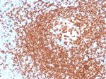 PAX5/BSAP (Early B-Cell Marker) Antibody in Immunohistochemistry (Paraffin) (IHC (P))