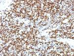 PAX7 (Rhabdomyosarcoma Marker) Antibody in Immunohistochemistry (Paraffin) (IHC (P))