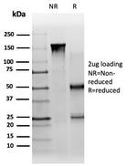 PBX1/PRL (Transcription Factor) Antibody in SDS-PAGE (SDS-PAGE)