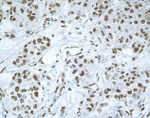 SMAD3 Antibody in Immunohistochemistry (IHC)