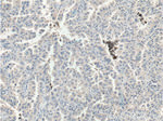 SIK1 Antibody in Immunohistochemistry (Paraffin) (IHC (P))