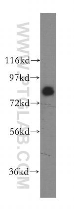 SIK1 Antibody in Western Blot (WB)