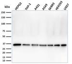 PCNA (Proliferating Cell Nuclear Antigen) (G1- and S-phase Marker) Antibody in Western Blot (WB)