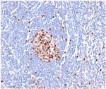 PCNA (Proliferating Cell Nuclear Antigen) (G1- and S-phase Marker) Antibody in Immunohistochemistry (Paraffin) (IHC (P))