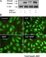 SMAD3 Antibody in Western Blot (WB)