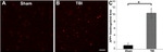 beta Amyloid Antibody in Immunohistochemistry (IHC)