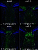 beta Amyloid Antibody in Immunohistochemistry (IHC)