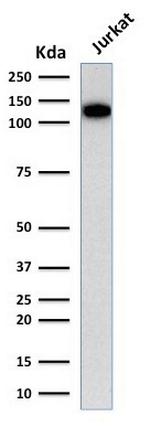 CD31/PECAM-1 (Endothelial Cell Marker) Antibody in Western Blot (WB)