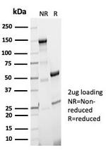 Aciculin/Phosphoglucomutase 5 (PGM5) Antibody in SDS-PAGE (SDS-PAGE)