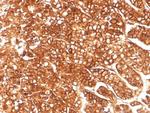 P-glycoprotein/p170/MDR1/CD243 Antibody in Immunohistochemistry (Paraffin) (IHC (P))