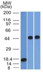 Alpha-1-Antitrypsin (SERPINA1) Antibody in Western Blot (WB)