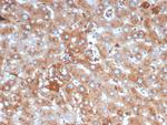 Alpha-1-Antitrypsin (SERPINA1) (Hepatocellular and Histiocytic Marker) Antibody in Immunohistochemistry (Paraffin) (IHC (P))