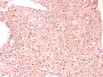 Alpha-1-Antitrypsin (SERPINA1) (Hepatocellular and Histiocytic Marker) Antibody in Immunohistochemistry (Paraffin) (IHC (P))