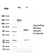 Alpha-1-Antitrypsin (SERPINA1) Antibody in SDS-PAGE (SDS-PAGE)
