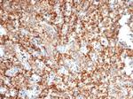 PIK3R2/Phosphoinositide-3-kinase regulatory subunit 2 Antibody in Immunohistochemistry (Paraffin) (IHC (P))