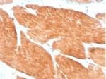 PIK3R2 (Phosphoinositide-3-kinase regulatory subunit 2) Antibody in Immunohistochemistry (Paraffin) (IHC (P))