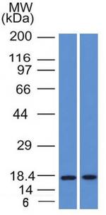 GCDFP-15 Antibody in Western Blot (WB)