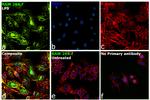 iNOS Antibody in Immunocytochemistry (ICC/IF)