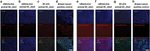 Pan Cytokeratin Antibody in Immunohistochemistry (IHC)