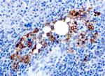 TRAcP (Tartrate-Resistant Acid Phosphatase) Antibody in Immunohistochemistry (Paraffin) (IHC (P))