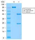 TRAcP (Tartrate-Resistant Acid Phosphatase) Antibody in SDS-PAGE (SDS-PAGE)