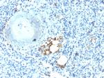 TRAcP (Tartrate-Resistant Acid Phosphatase) Antibody in Immunohistochemistry (Paraffin) (IHC (P))