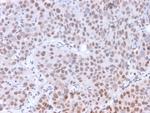 Phospho-RNA pol II CTD (Ser5) Antibody in Immunohistochemistry (Paraffin) (IHC (P))