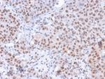 Phospho-RNA Polymerase II CTD Repeat YSPTSPS (Ser5) Antibody in Immunohistochemistry (Paraffin) (IHC (P))