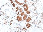 ACTH (Adrenocorticotrophic Hormone) (Pituitary Marker) Antibody in Immunohistochemistry (Paraffin) (IHC (P))