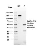 ACTH (Adrenocorticotrophic Hormone) (Pituitary Marker) Antibody in SDS-PAGE (SDS-PAGE)